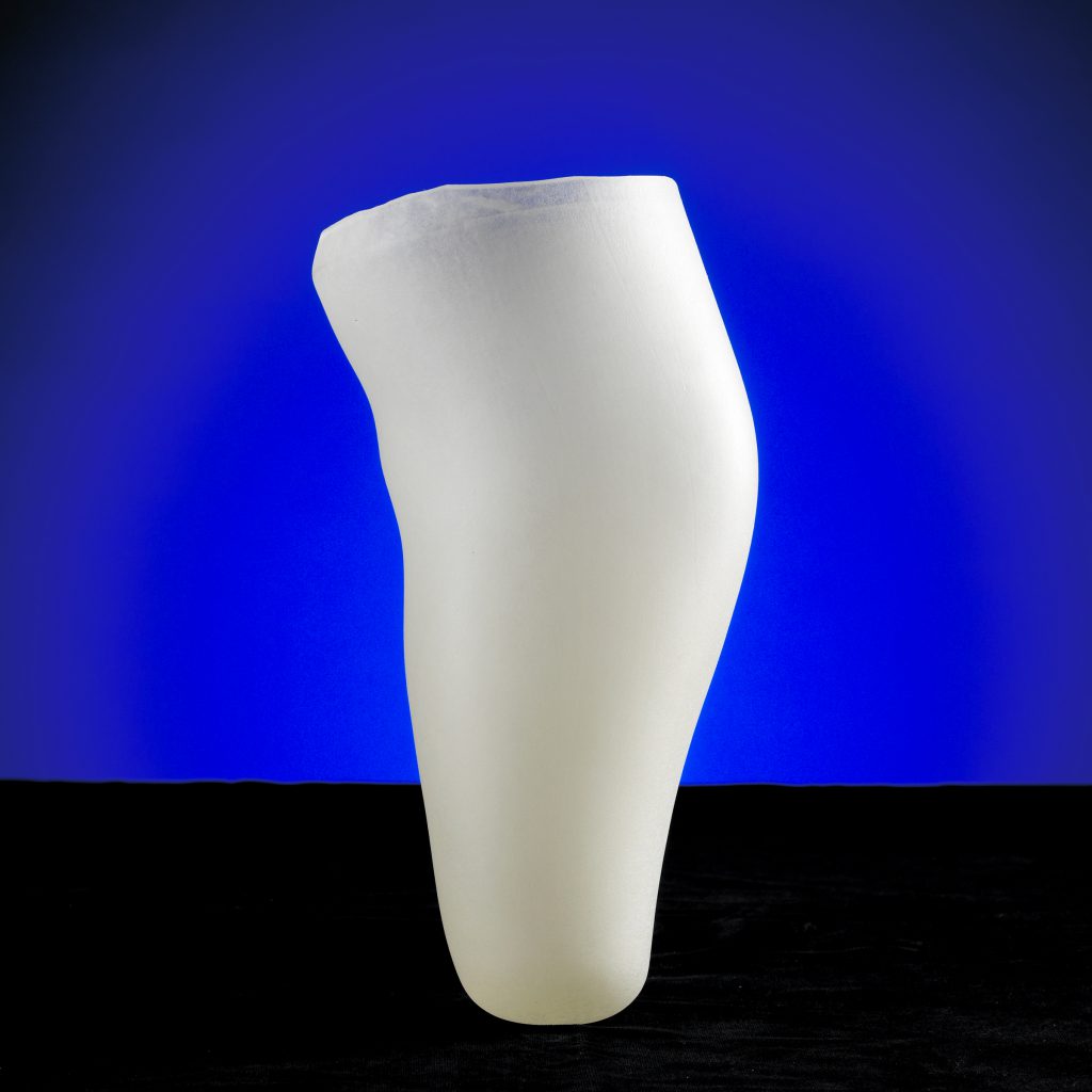 Custom Liners Erdmann Prosthetics and Orthotics Sacramento Roseville